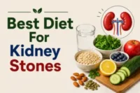 Best Diet for Kidney Stones: What Should You Eat? 